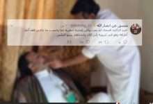 حقيقة إصابة صالح الصماد وبتر أحد اطرافه ونفي خبر مقتل صالح الصماد 3
