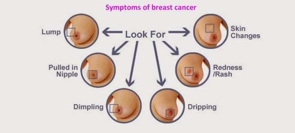 أعراض سرطان الثدي " توهج الجلد " 1