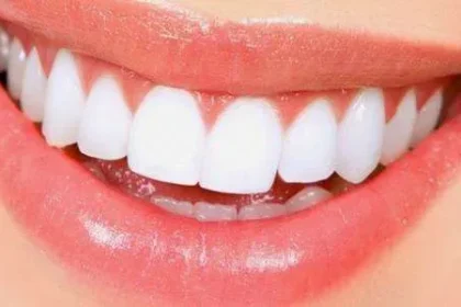 4 وصفات طبيعية لتبييض الأسنان والقضاء على التسوس..