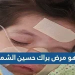 ما هو مرض براك حسين الشمري