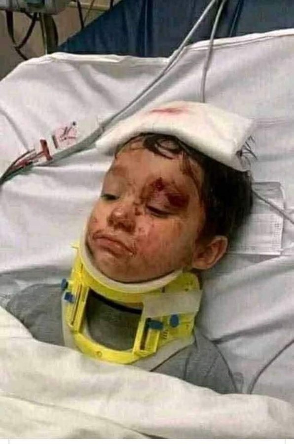 حقيقة وفاة الطفل ريان المغربي سبب وفاة الطفل ريان مات 4