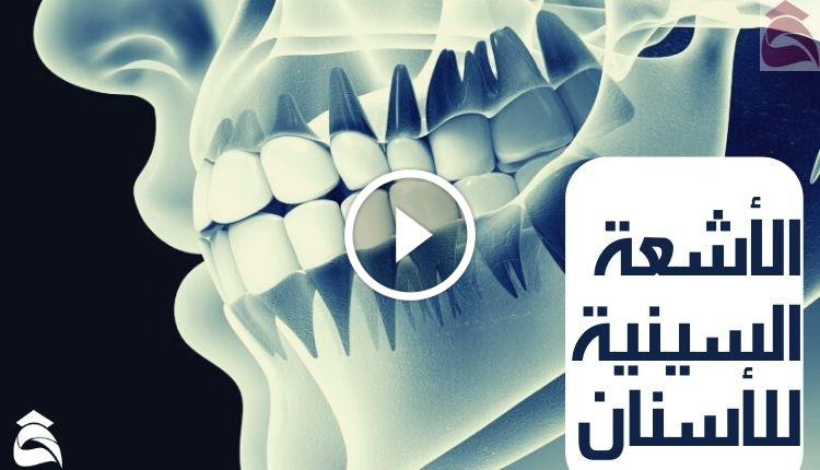 الأشعة السينية للأسنان؛ أهم 4 أنواع لها وكيف تستعد