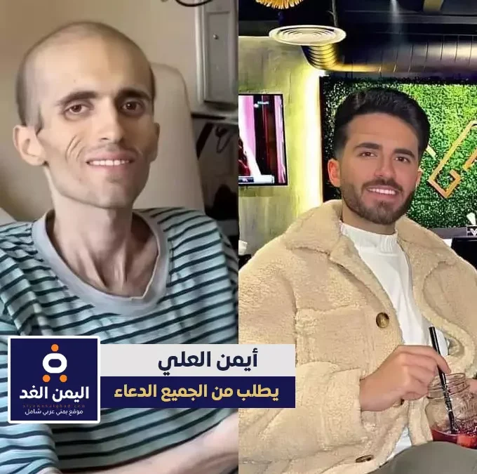 حقيقة وفاة أيمن العلي ملك جمال الأردن