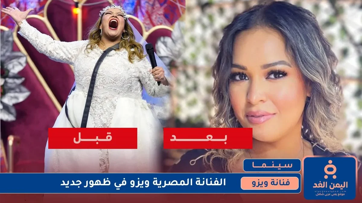 صور الفنانة ويزو
