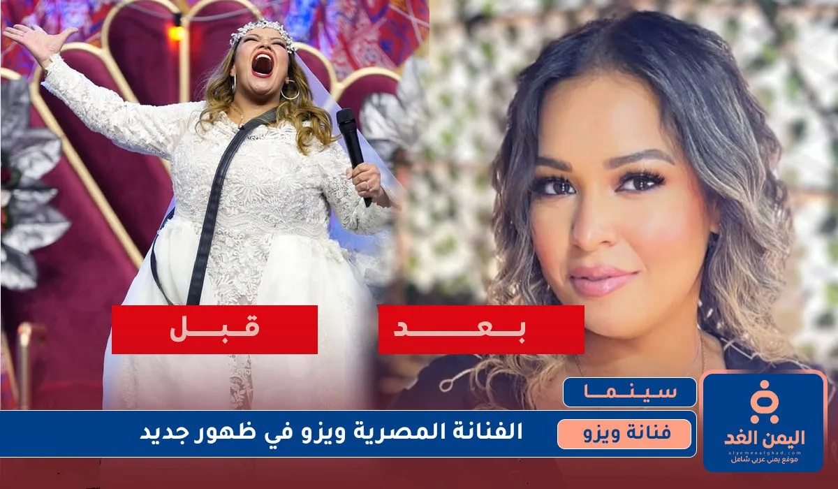صور الفنانة ويزو 