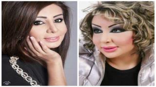 حقيقة تشوه وجه شيماء علي بعد عملية التجميل حقيقة وفاة الفنانة شيماء علي