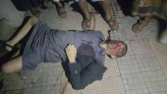 صور من مقتل خالد الرضي في إشتباكات جولة المصباحي وبيان المؤتمر حول مقتله