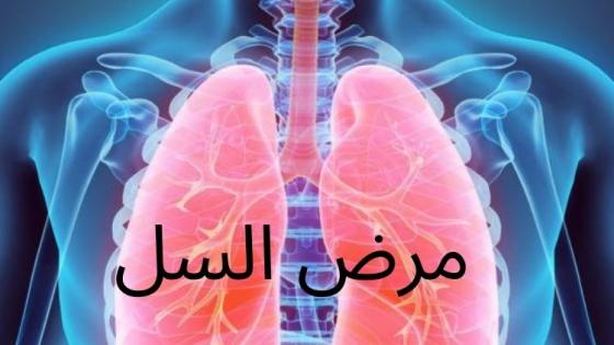 مرض السل(Tuberculosis)؛ أعراضه وأسبابه - شبكة فهرس